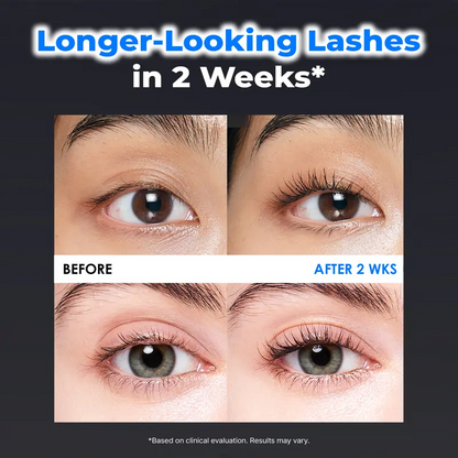 💞70K+ SOLD! ✨Eyelash Growth Serum- Safe & Gentle Lashes Care, Fuller, Thicker in 2 Weeks, Non-Prostaglandin